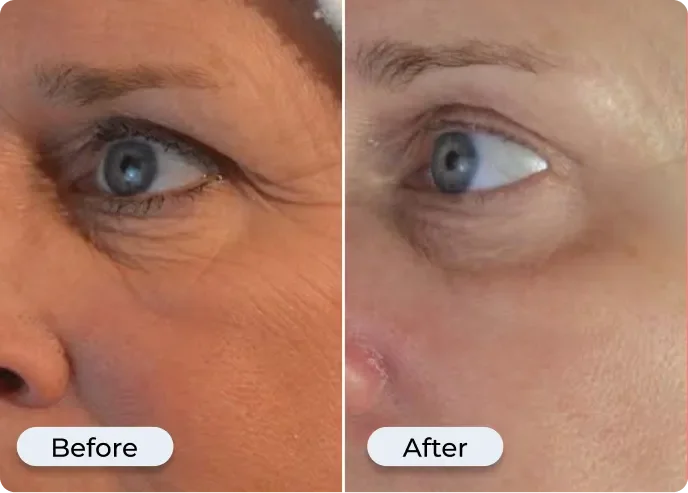 Smooth, Youthful Skin