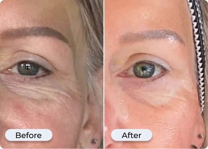 Visible Results Quickly